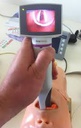 VIDEOLARINGOSCOPIO